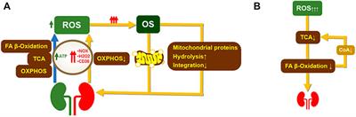 Inflammation and Cardiovascular Disease Associated With Hemodialysis for End-Stage Renal Disease